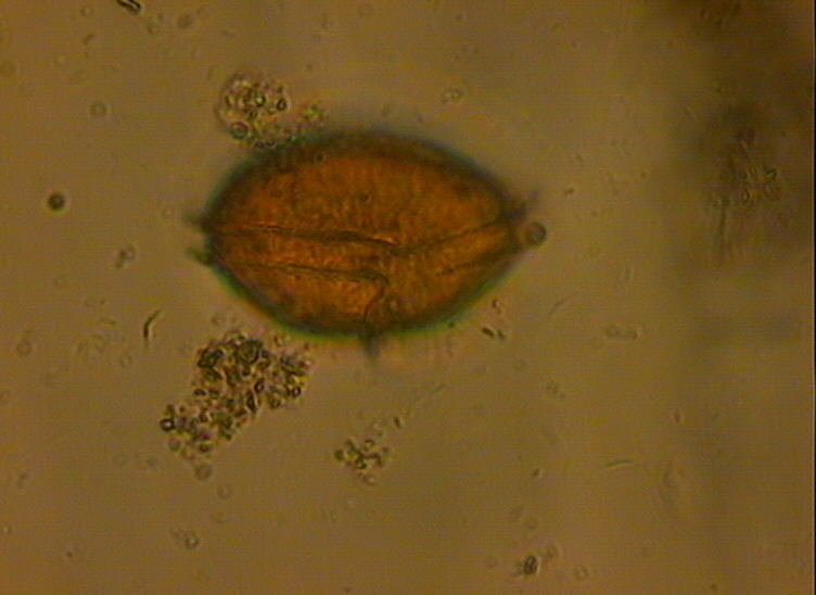 Dictyocha speculum